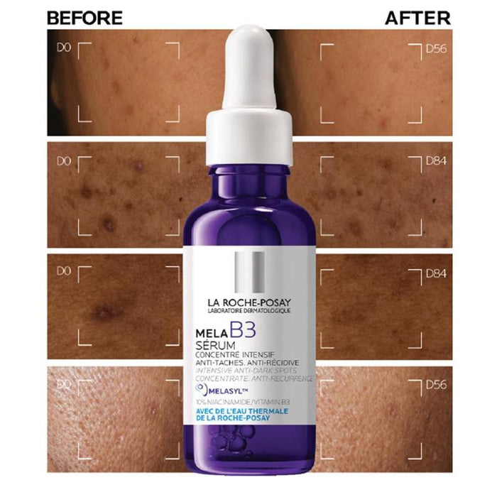La Roche-Posay Mela B3 Serum 30ml
