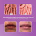 QV Intensive Sting-Free Ointment 100g - image 3
