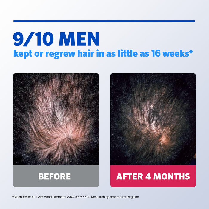 Regaine Men's Extra Strength FOAM Hair Regrowth Treatment (4 months supply) - image 5