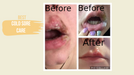 Yes Organics Lemon Balm & Geranium Prevent and Heal Lip Balm - image 4